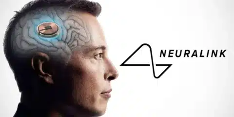 شريحة Neuralink